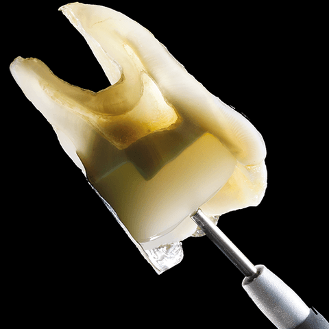 Composite SDR Flow Dentsply